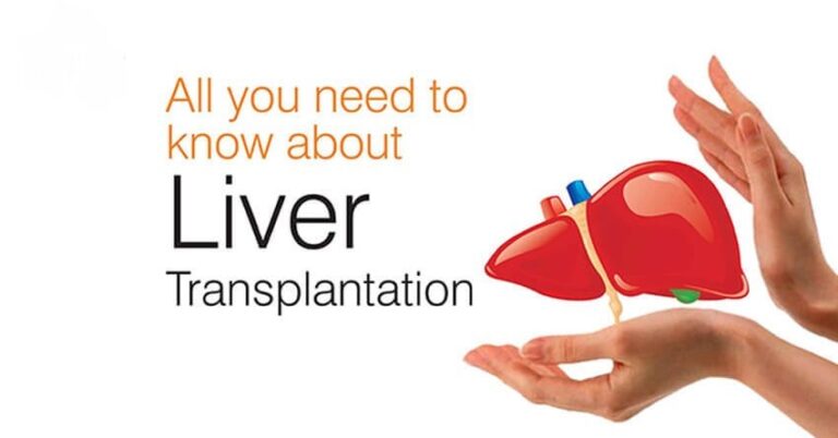 ALL YOU NEED TO KNOW ABOUT LIVER TRANSPLANT - Dr. Bhate