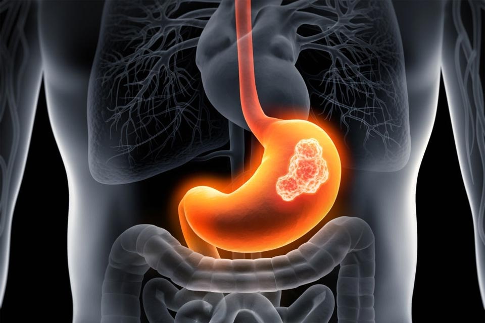 WHAT DISEASES AND CONDITIONS AFFECT THE STOMACH Dr Bhate