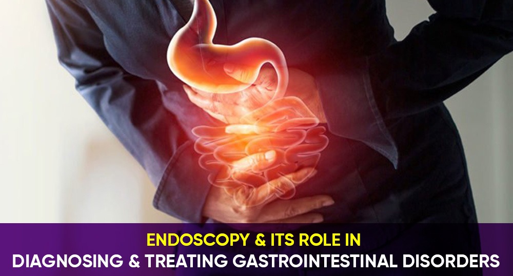 Endoscopy and its role in diagnosing and treating Gastrointestinal ...