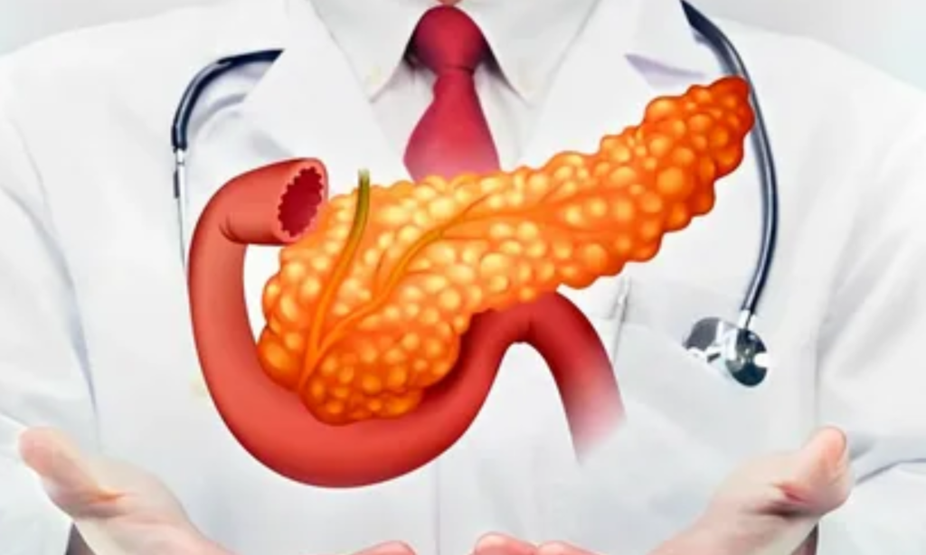 Treatment Options for Acute Pancreatitis